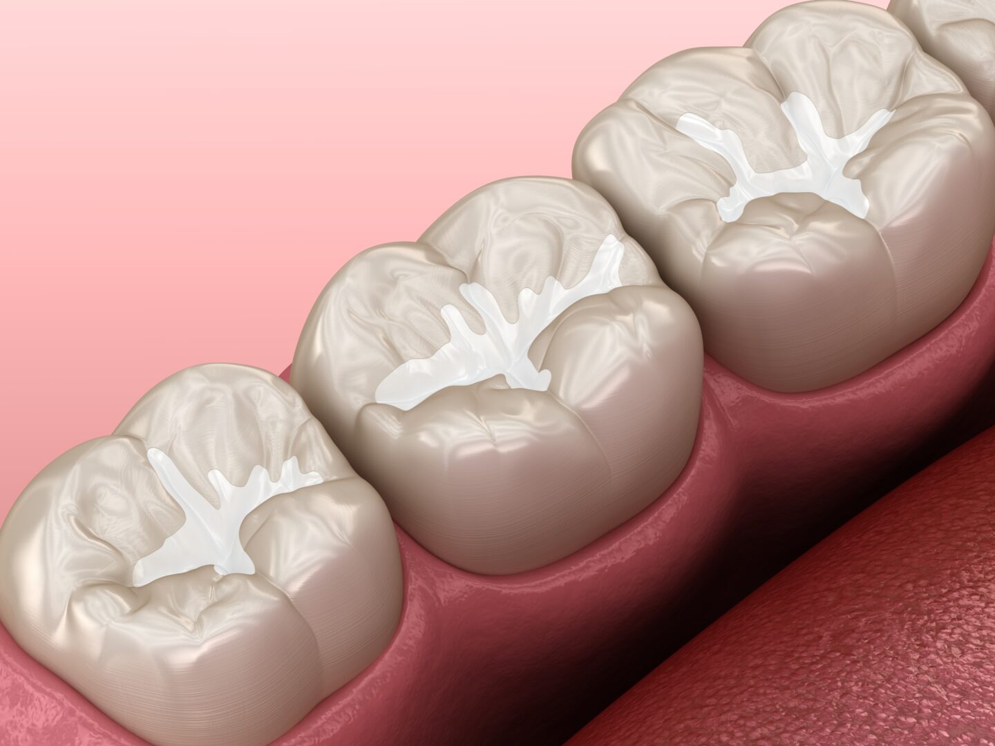 Dental Sealants Norton Shores MI | Community Shores Dental
